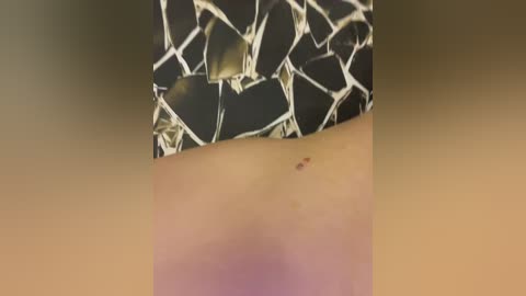 Video of a close-up of a person's thigh, showing a small, raised, dark red spot, possibly a bug bite, on light skin. The background features a black-and-white geometric patterned fabric.