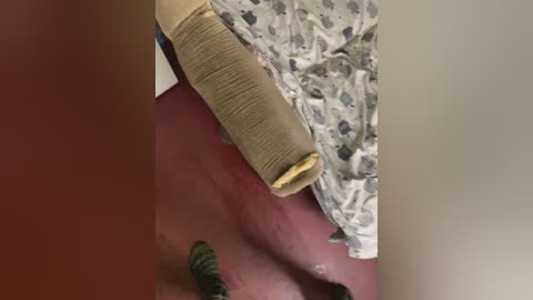 Video of a close-up view of a red-skinned arm with a beige bandage and a patterned gray and white blanket. The arm shows a slight discoloration and faint lines.