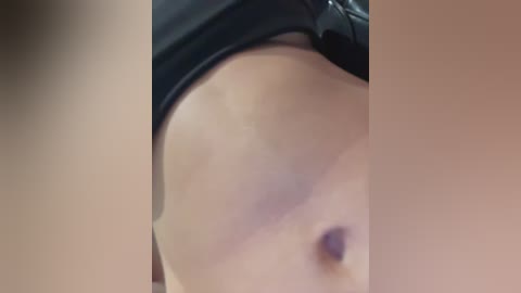 Media: Video of a close-up, side view of a woman's bare chest with a noticeable bruise on the left breast, wearing a black bra. The background is blurred.