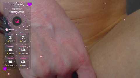 Video of a close-up hand with visible redness and a slight rash, likely from dry skin. The background shows a light brown surface with a virtual health app overlay displaying vital signs.