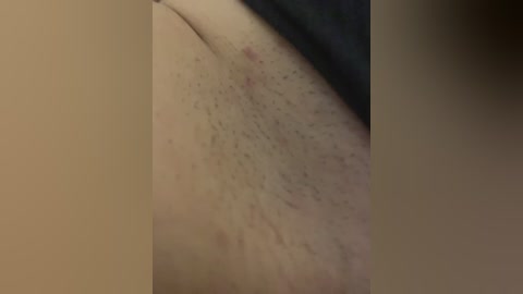Close-up video of a person's lower back and buttocks, showing a light skin tone with faint acne and fine body hair. The background is blurred, revealing a dark fabric likely clothing.