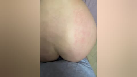 Video of a nude, fair-skinned person's buttocks, with visible red marks and a light blue fabric beneath.