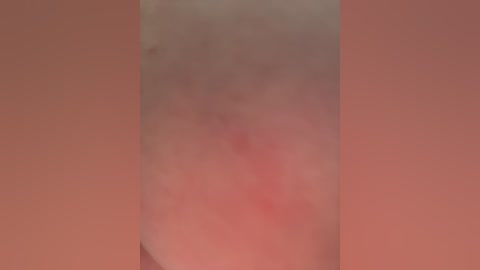 A close-up video of a person's inner thigh, showing a red, irritated rash with a raised texture, set against a soft, peach-colored background. The image is slightly blurred, making details indistinct.