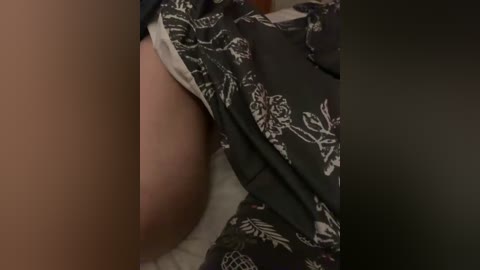 Video of a close-up of a person's thigh and inner thigh, showing light skin tone and black floral-patterned fabric.