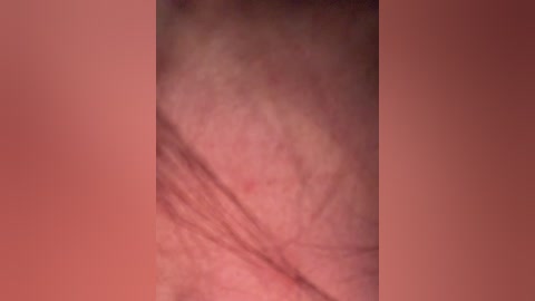 Video of a close-up view of a person's inner thigh, showing skin texture with fine hair, slight discoloration, and a subtle crease, set against a plain, soft pink background.