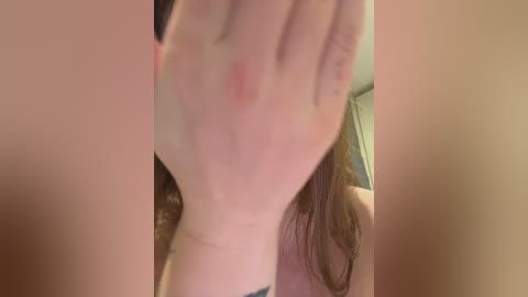 Video of a fair-skinned hand with a red, inflamed rash, partially covering a woman's face. The background shows blurred, greenish walls and a hint of a blue patterned shirt.