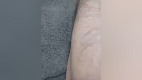 A close-up video of a pale, hairy, human forearm with a prominent scar on the upper arm against a grey towel background.
