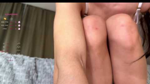 Video of a close-up of a person\u2019s thighs with visible redness, sitting on a gray, fuzzy blanket. The background features a brown curtain and a partially visible pink bedsheet.