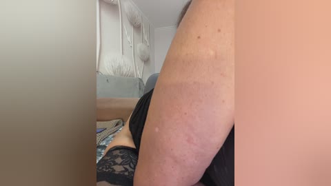 Video of a woman's arm with a visible rash, wearing a black top, in a living room with a beige couch, white wall art, and a decorative blanket.